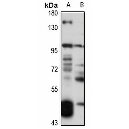 DOC1 Rabbit Polyclonal Antibody