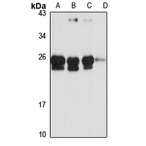 FKBP14 Rabbit Polyclonal Antibody
