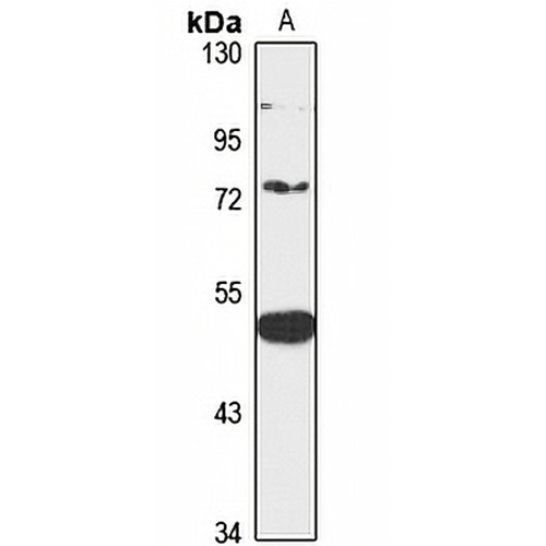 Folliculin Rabbit Polyclonal Antibody