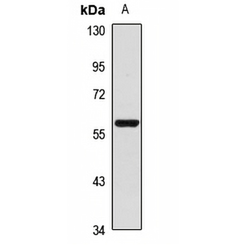FLVCR1 Rabbit Polyclonal Antibody