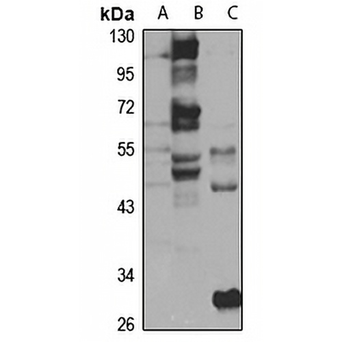 FLVCR2 Rabbit Polyclonal Antibody