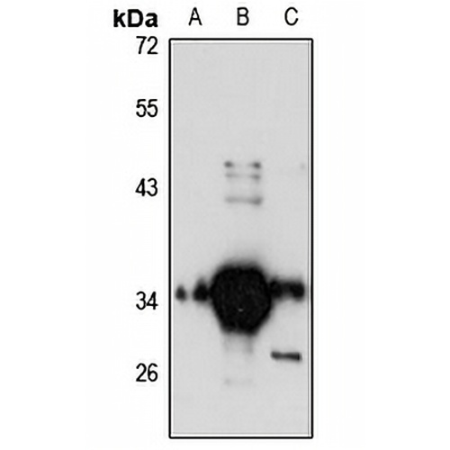 FN3K Rabbit Polyclonal Antibody