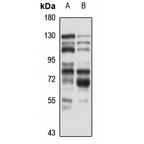 FNBP1 Rabbit Polyclonal Antibody