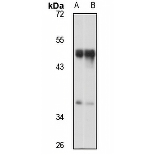 FOXL2 Rabbit Polyclonal Antibody