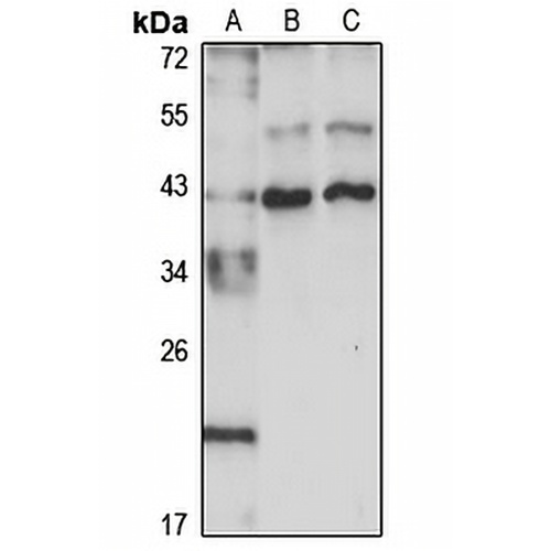 FOXR2 Rabbit Polyclonal Antibody