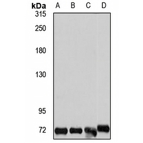 FREM1 Rabbit Polyclonal Antibody