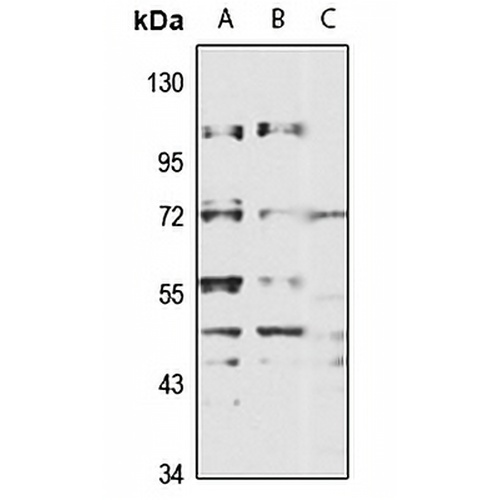 FRMD6 Rabbit Polyclonal Antibody