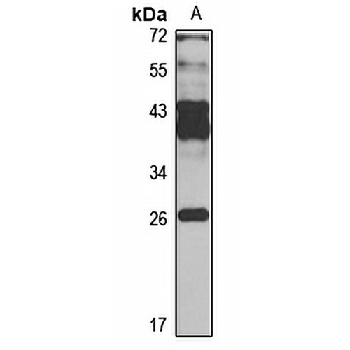 FTSJ1 Rabbit Polyclonal Antibody