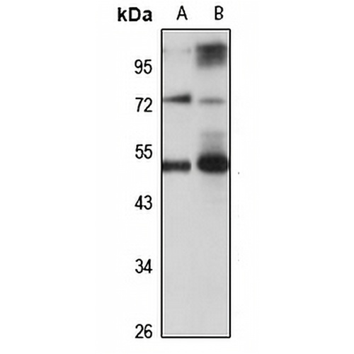 FUT7 Rabbit Polyclonal Antibody