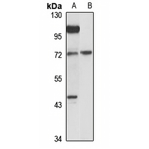 FUT8 Rabbit Polyclonal Antibody
