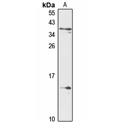 G0S2 Rabbit Polyclonal Antibody