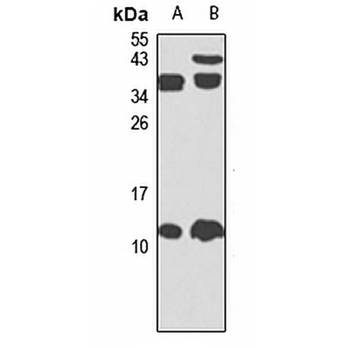 G0S2 Rabbit Polyclonal Antibody