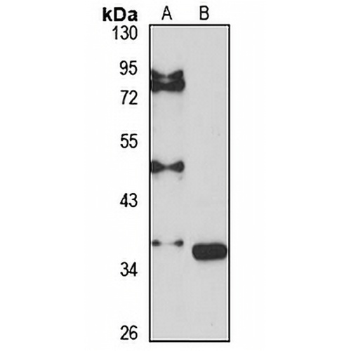 G6Pase-beta Rabbit Polyclonal Antibody