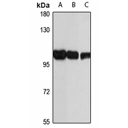 GAA Rabbit Polyclonal Antibody