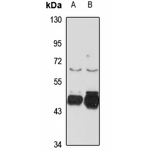 GABRB3 Rabbit Polyclonal Antibody