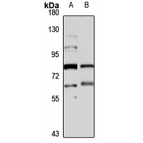 GABRR2 Rabbit Polyclonal Antibody