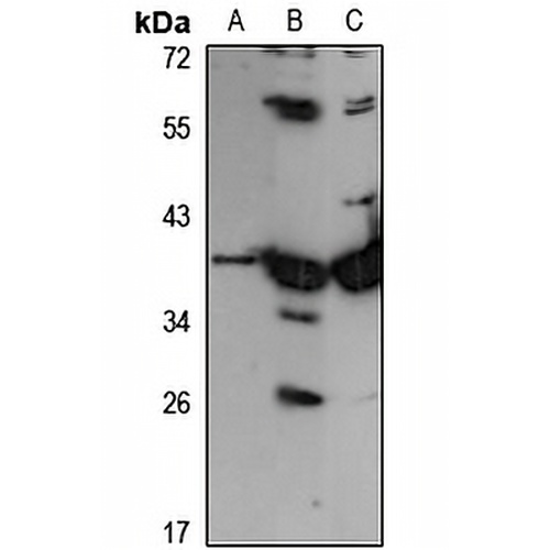 GALM Rabbit Polyclonal Antibody