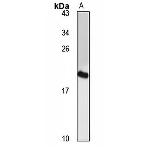 GALP Rabbit Polyclonal Antibody