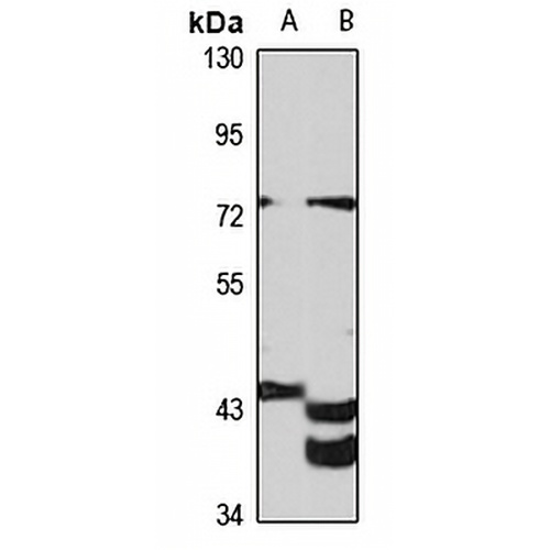 Gigaxonin Rabbit Polyclonal Antibody