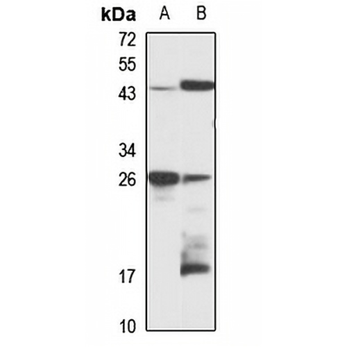 NOLA1 Rabbit Polyclonal Antibody