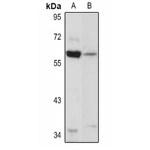 GATA6 Rabbit Polyclonal Antibody
