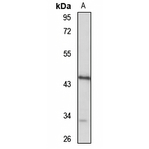 GCAT Rabbit Polyclonal Antibody