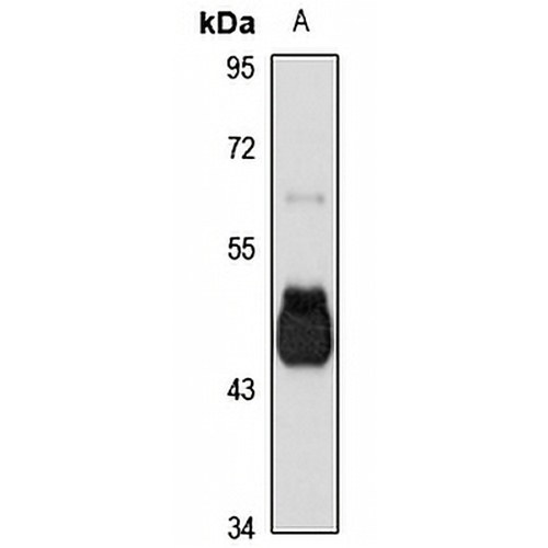 GCNT1 Rabbit Polyclonal Antibody