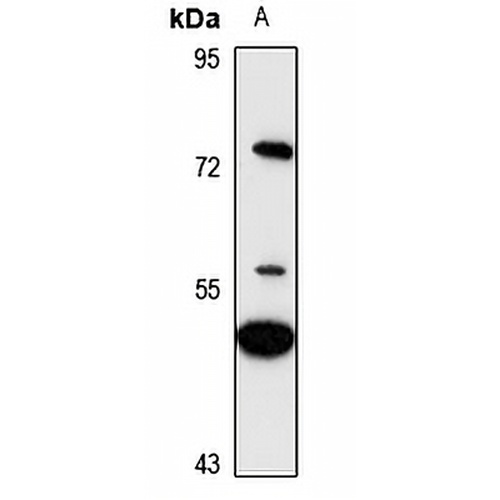 GCNT3 Rabbit Polyclonal Antibody
