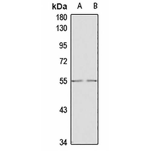 GDF5 Rabbit Polyclonal Antibody