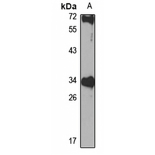 KIR Rabbit Polyclonal Antibody