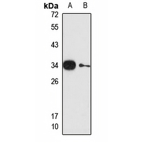 Gemin8 Rabbit Polyclonal Antibody