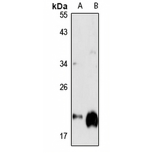 GGCT Rabbit Polyclonal Antibody
