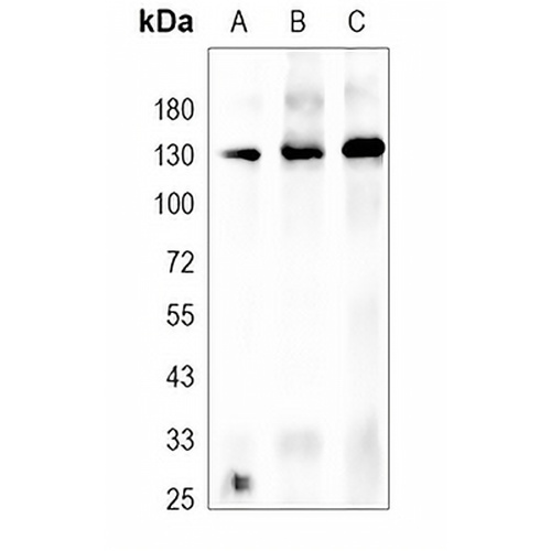 GHR Rabbit Polyclonal Antibody