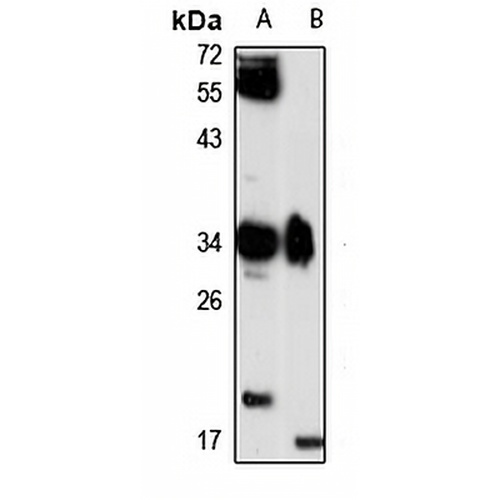 GIMAP5 Rabbit Polyclonal Antibody