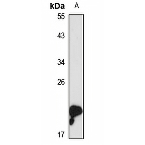 Gastrokine-1 Rabbit Polyclonal Antibody