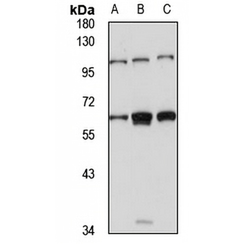 GLCCI1 Rabbit Polyclonal Antibody