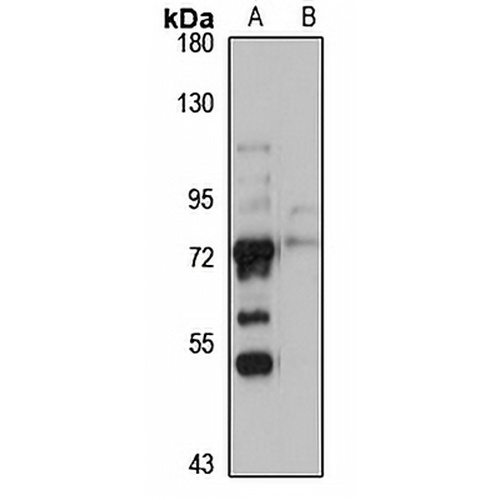 GLIS3 Rabbit Polyclonal Antibody