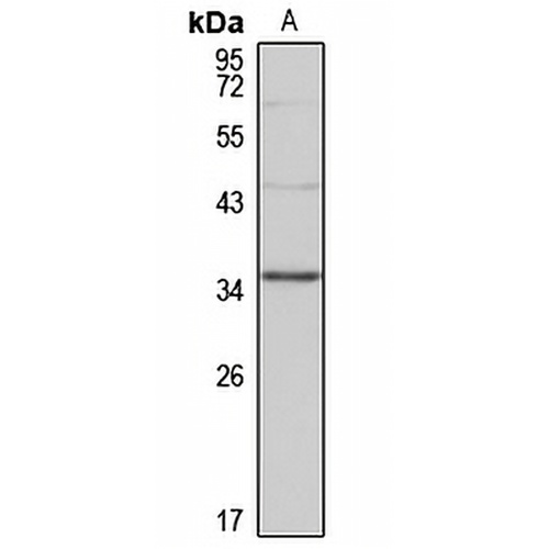 GLYAT Rabbit Polyclonal Antibody