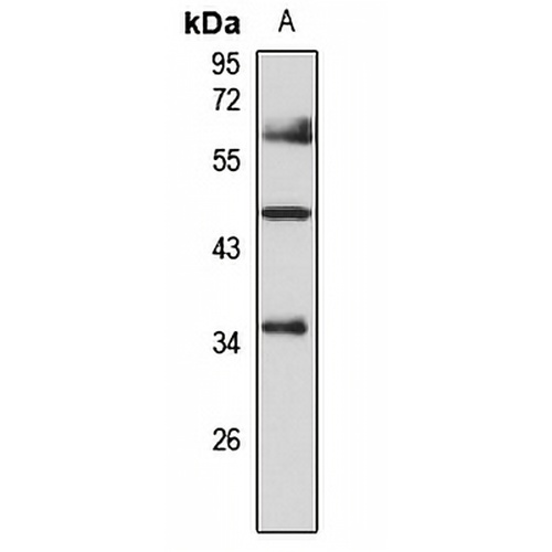 GNAT2 Rabbit Polyclonal Antibody