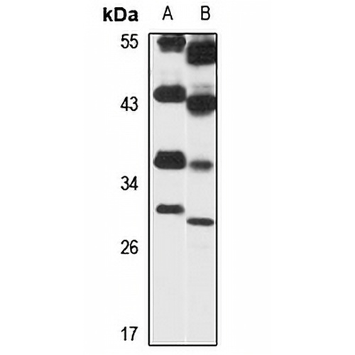 GNPDA1 Rabbit Polyclonal Antibody