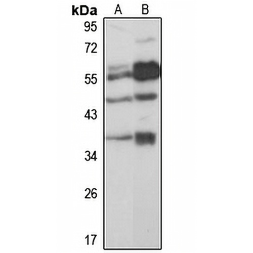 GNRHR Rabbit Polyclonal Antibody
