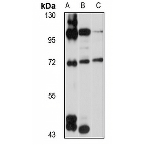 GPATCH2 Rabbit Polyclonal Antibody