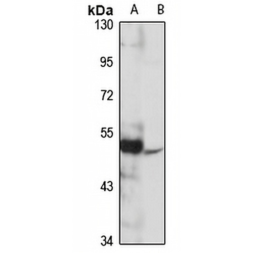 GPER Rabbit Polyclonal Antibody