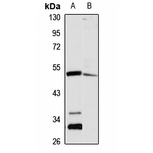 T54 Rabbit Polyclonal Antibody