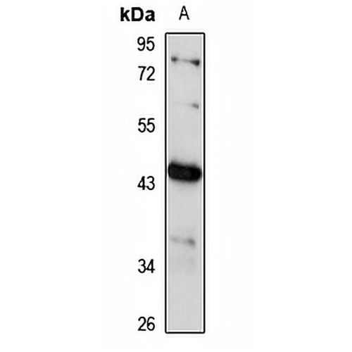 GPR32 Rabbit Polyclonal Antibody