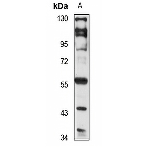 GPR37 Rabbit Polyclonal Antibody