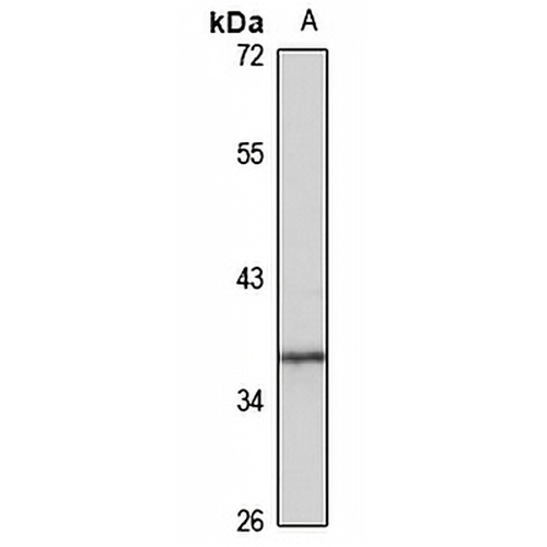 GPR6 Rabbit Polyclonal Antibody