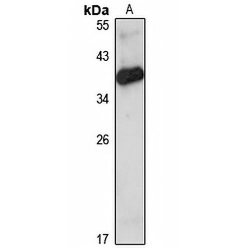 GRAP Rabbit Polyclonal Antibody