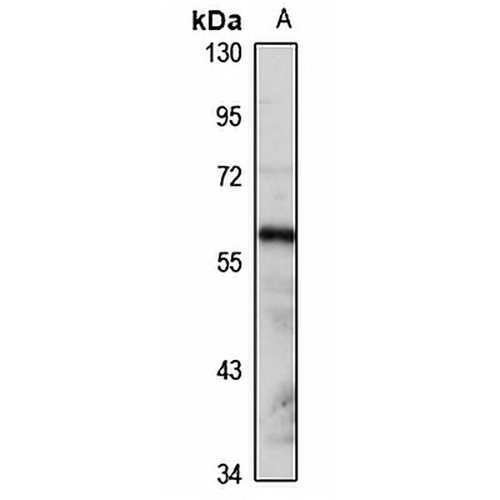 GRB7 Rabbit Polyclonal Antibody
