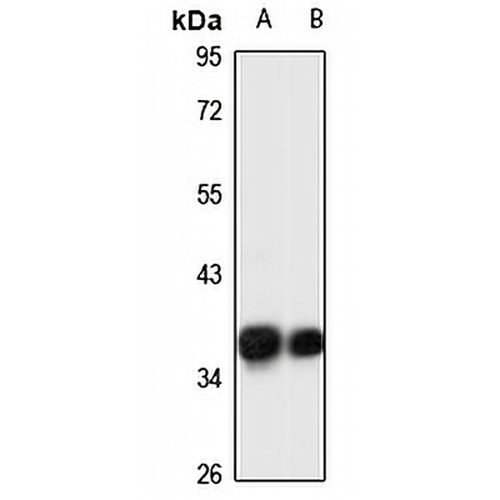GRHPR Rabbit Polyclonal Antibody